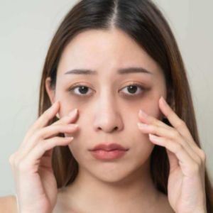 Skincare for Dark Circles
