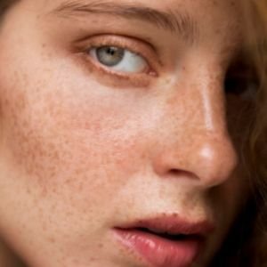 Skincare for Dull