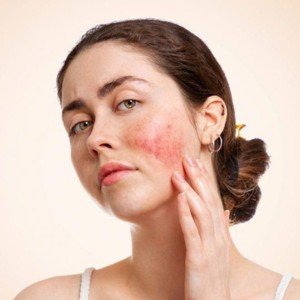 Skincare for Sensitive Skin