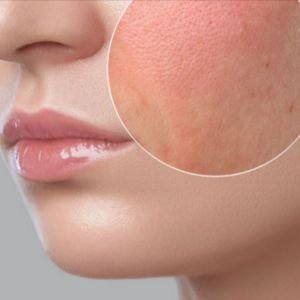 Best Skincare for Dry Skin in Bangladesh – Glow Up Skin Care BD