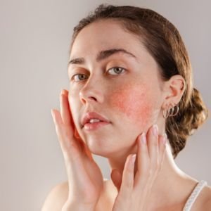 Best Skincare for Sensitive Skin in Bangladesh – Glow Up Skin Care BD